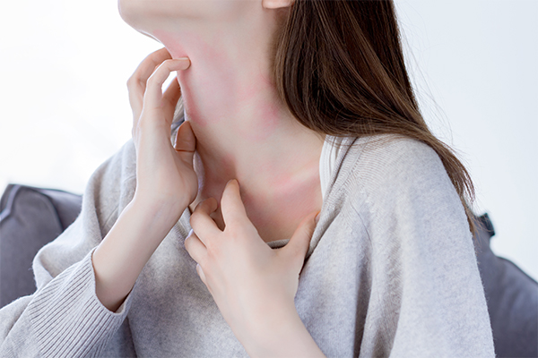 アレルギー体質・皮膚炎・かゆみの症状例